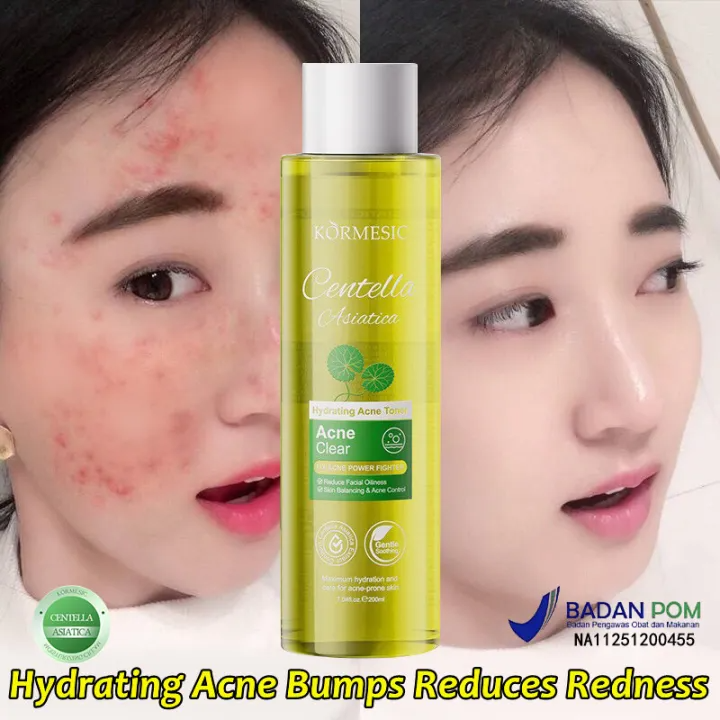 Centella Asiatica Facial Toner – Oil Control Hydrating Toner (200ml)