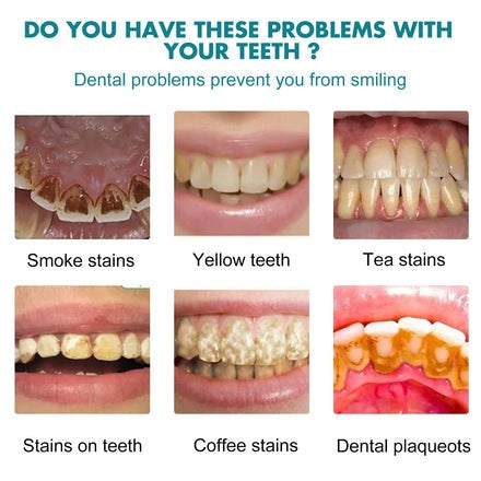 Teeth Whitening Paint — Instantly Brighter Smile