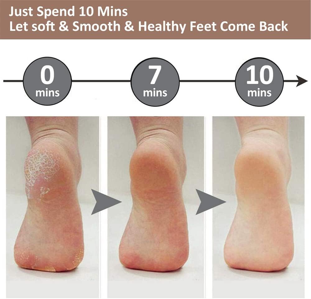 🔋Rechargeable Electric Callus Remover