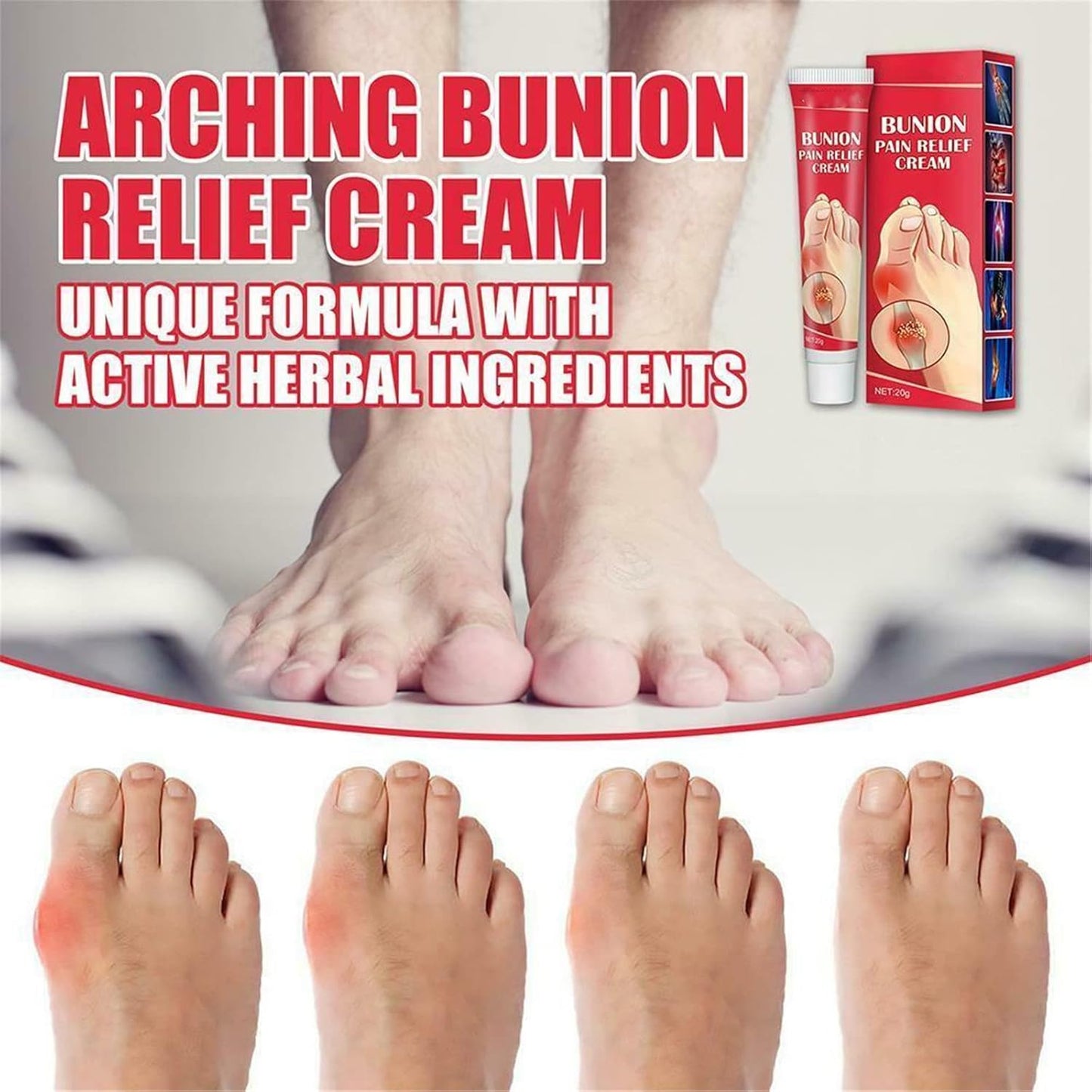 Bunion Pain Relief Cream – Soothing Herbal Comfort for Achy Feet