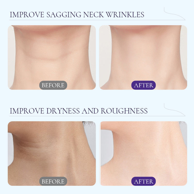 Niacinamide Peptide Neck Cream – Lift, Firm & Smooth Lines