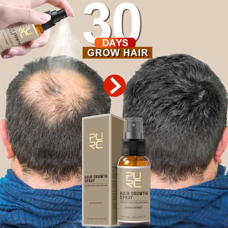 New Hair Growth Spray - Fast Hair Growth - Prevent Hair Loss