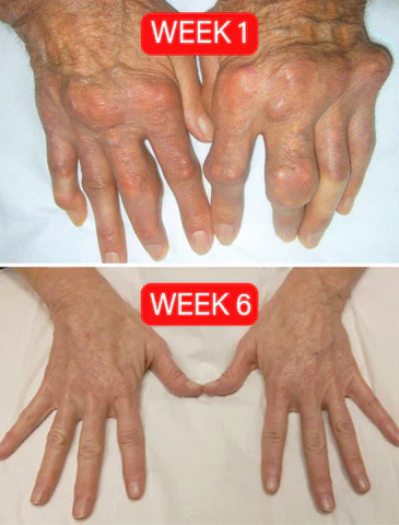 beevenom™ Joint Pain Relief Gel