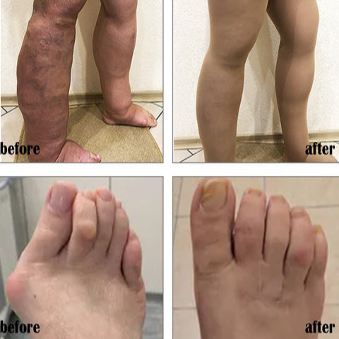 Perfectx Joint & Bone Therapy Cream