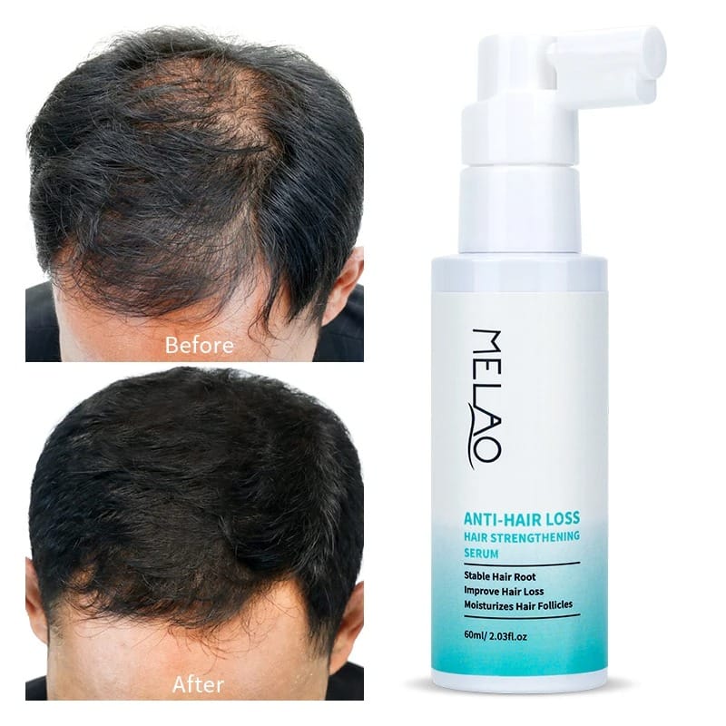 VitaGrow Revitalizing Hair Spray