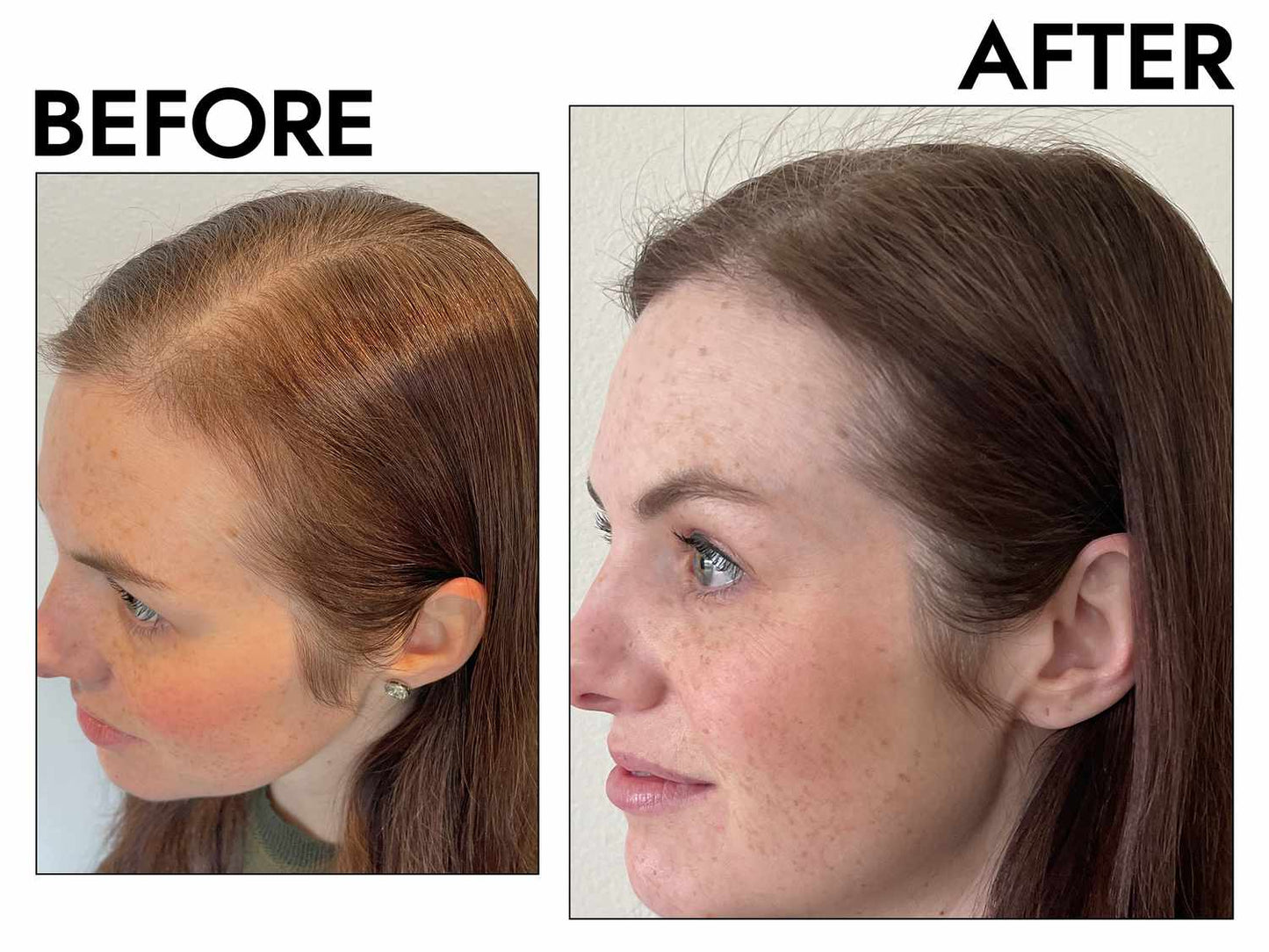 Anti-Hair Loss & Hair Growth Shampoo
