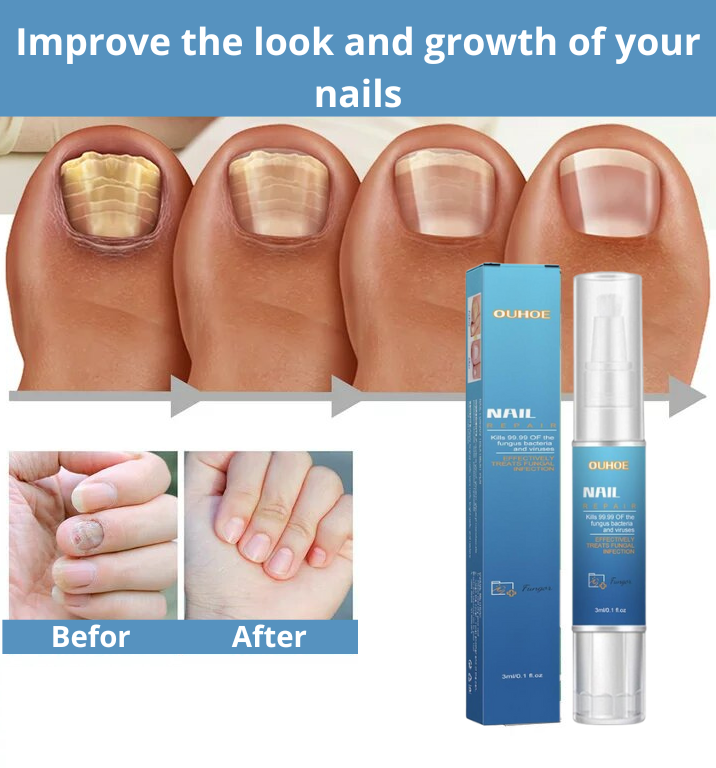 Nail Repair Pen
