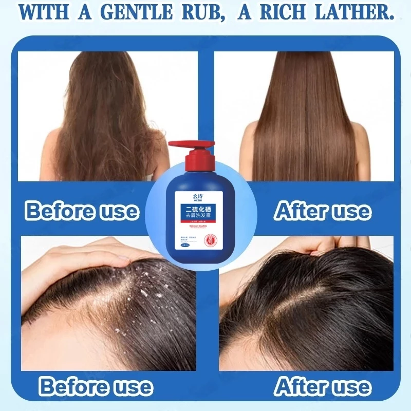 Anti Dandruff Shampoo – Japanese scalp care formula