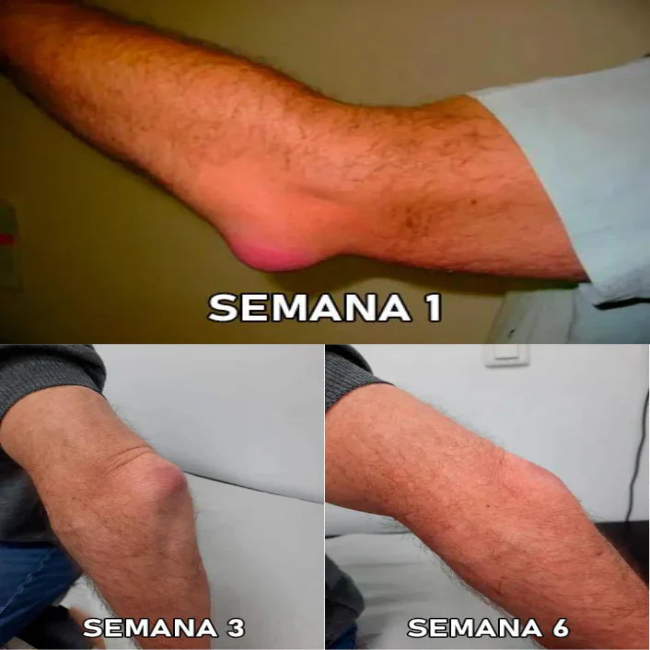 Perfectx Joint & Bone Therapy Cream