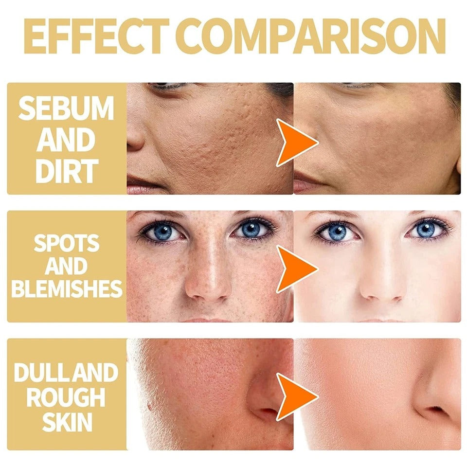 Reveal Radiant Skin — Yellow Peel Oil Treatment 🍋