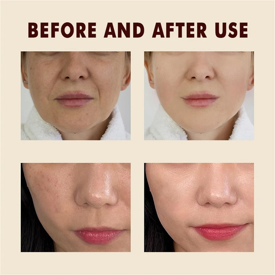 Rice Face Peel Shot – White & Black Rice Exfoliating Essence