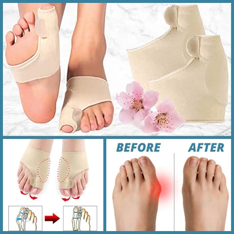 Premium Bunion Corrector (set of 2 pieces)