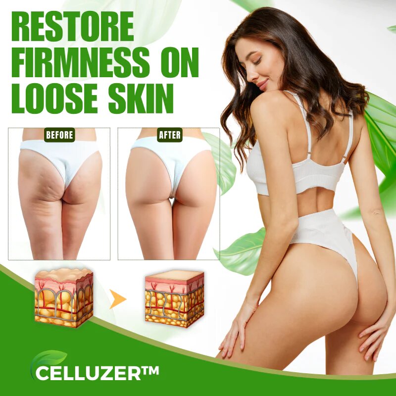 CELLUZER™ Wormwood CelluliteBeGone Skin Tighten Cream