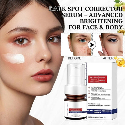 Dark Spot Corrector Serum – Advanced Brightening for Face & Body