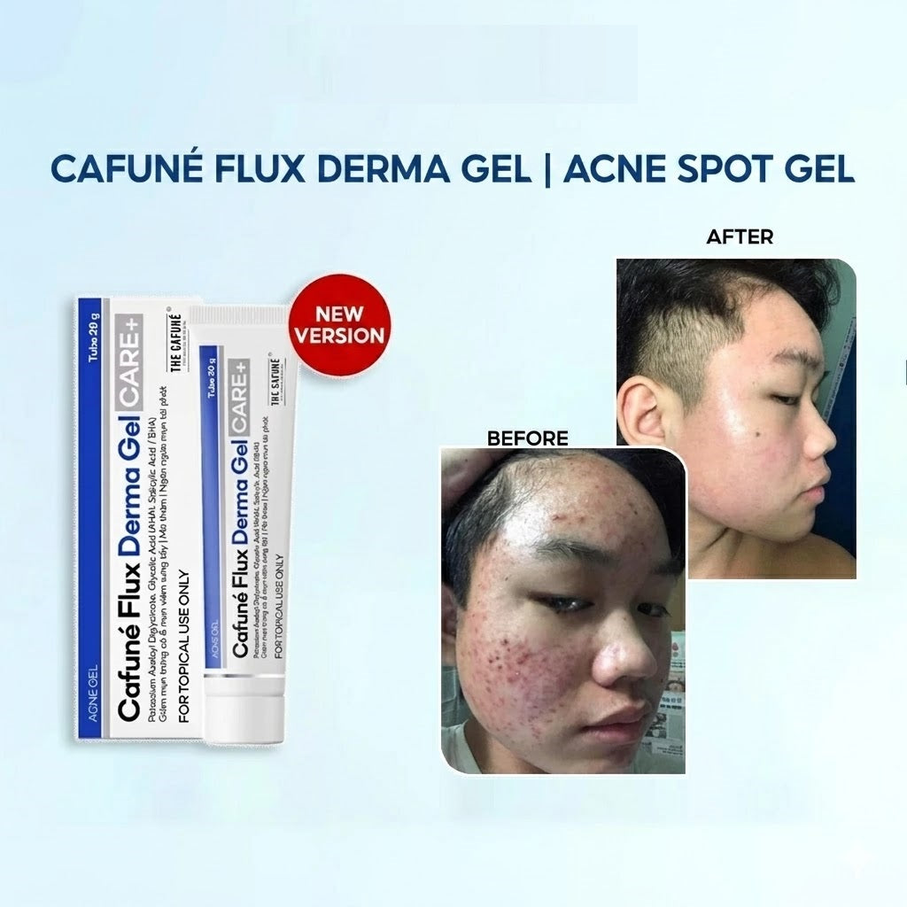 Cafuné Acne Spot Gel – Fade Acne Marks & Control Breakouts
