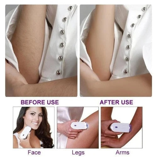 Smooth Skin at Home — Laser Hair Removal Made Easy