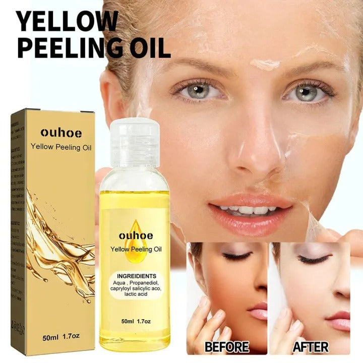Body Yellow Exfoliating Oil – Brightening & Moisturizing Body Care (100ml)