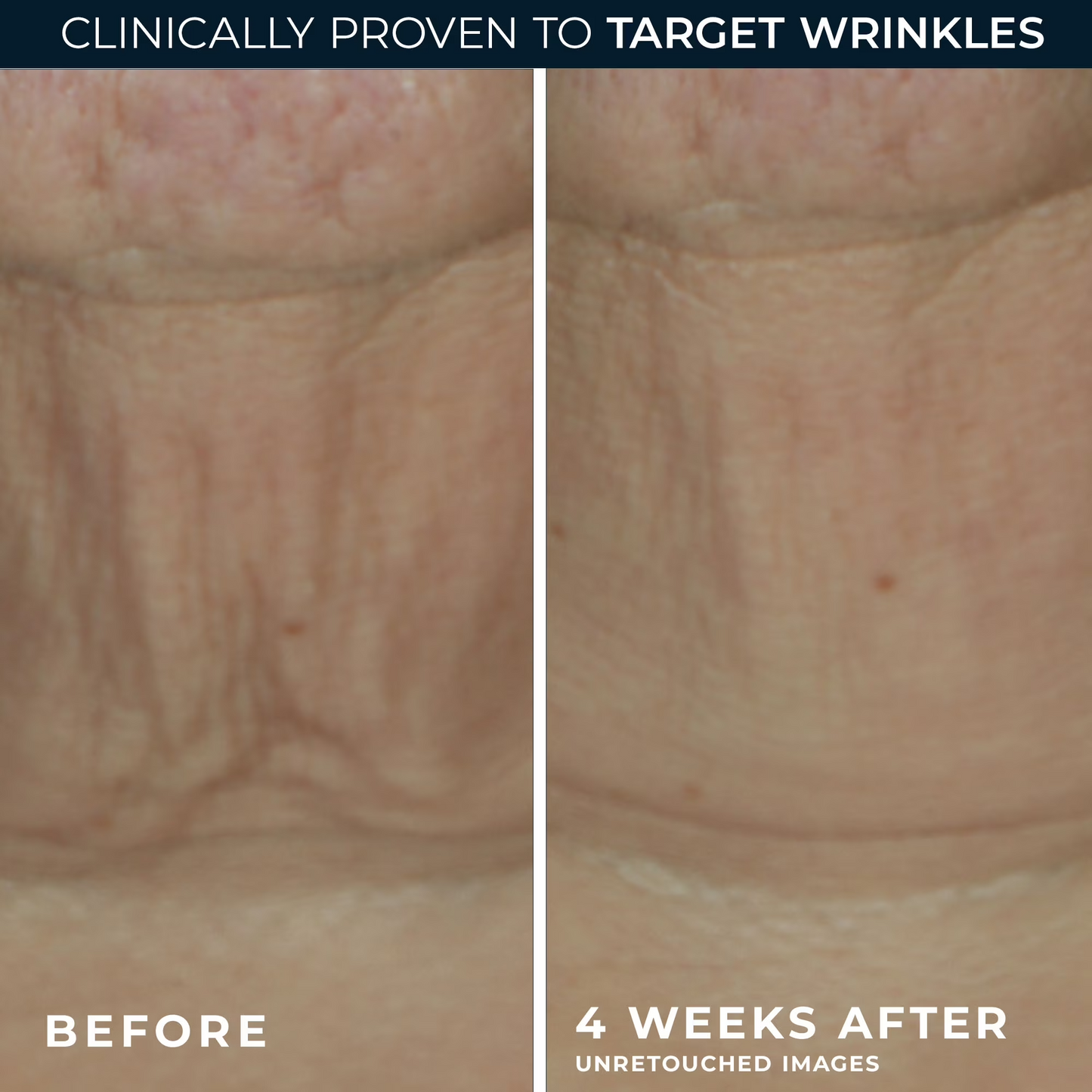 Retinol Firming Serum Bars – Anti-Aging Face & Neck Care Treatment