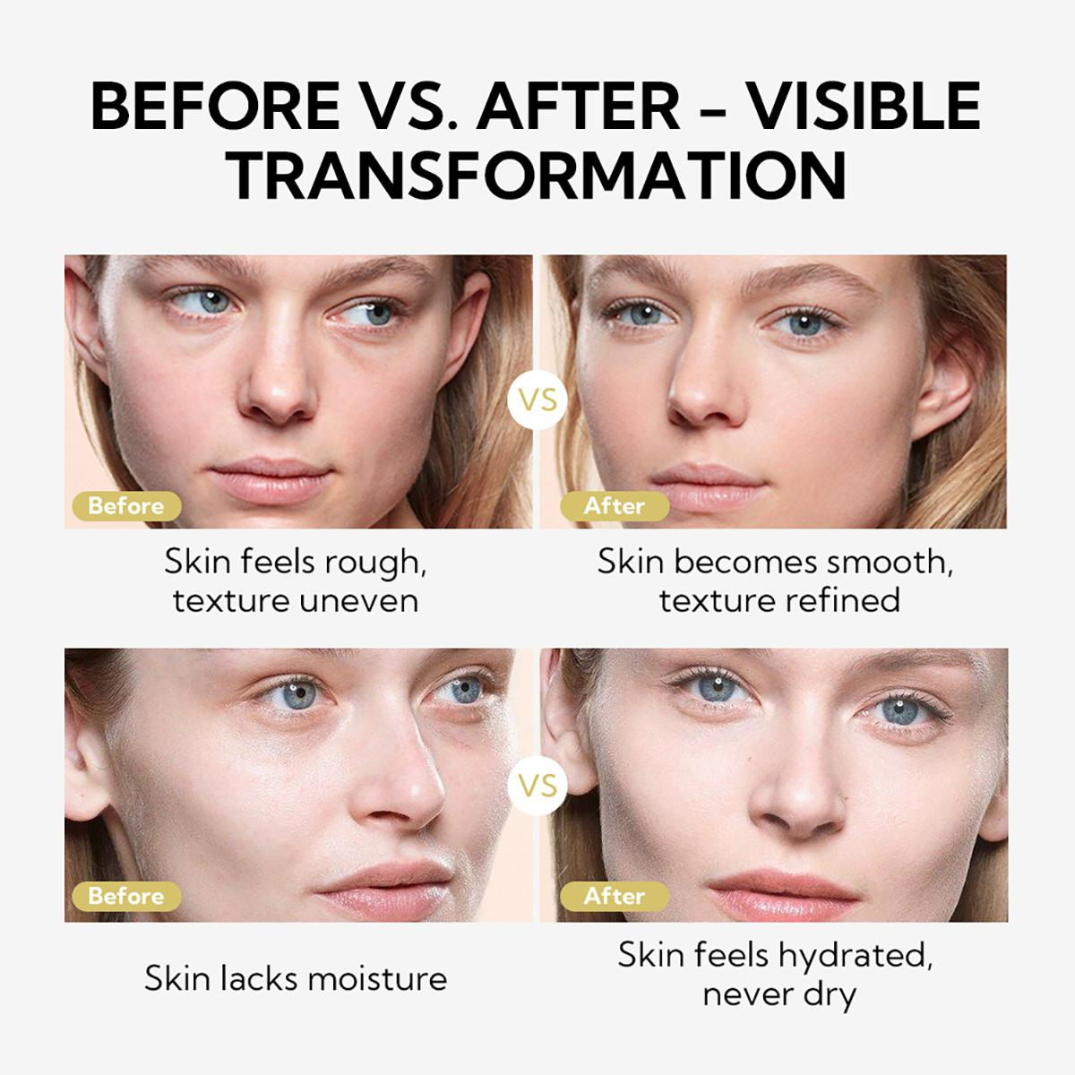 Exfoliating Peel Spray for Body – Aloe Vera Hydrating Skin Renewal