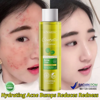 Centella Asiatica Facial Toner – Oil Control Hydrating Toner (200ml)