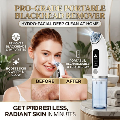 Portable LED Rechargeable Blackhead Remover