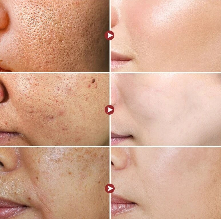 Oligopeptide Foam Cleansing Serum