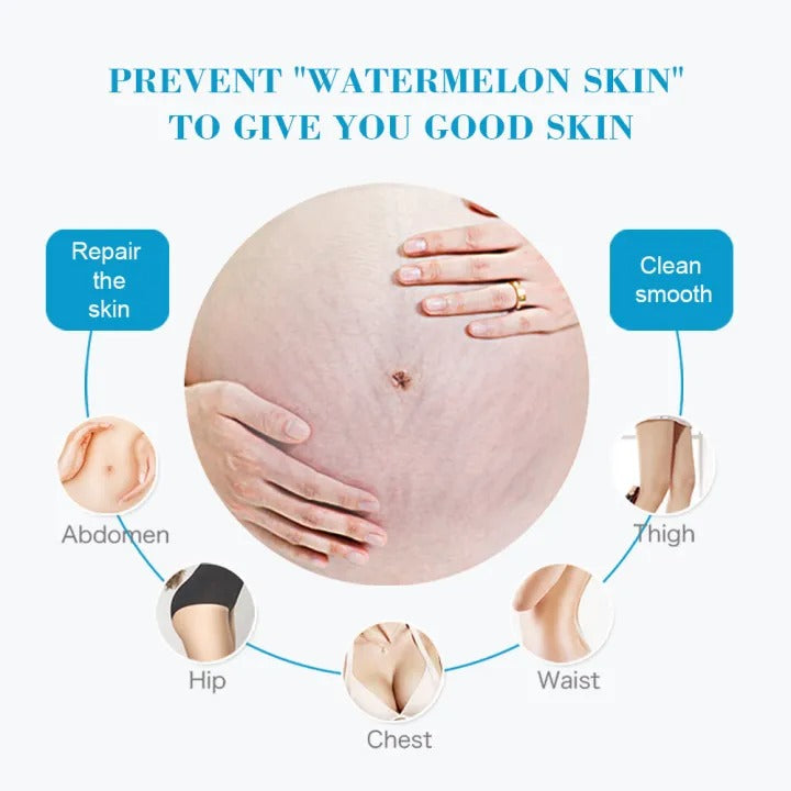 Aichun Beauty Natural Pregnancy Stretch Mark Cream