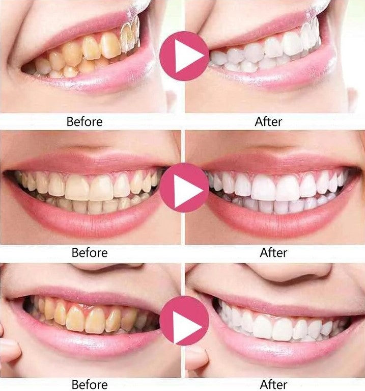 Toothpaste for Cleaning and Reducing Bacterial Odors