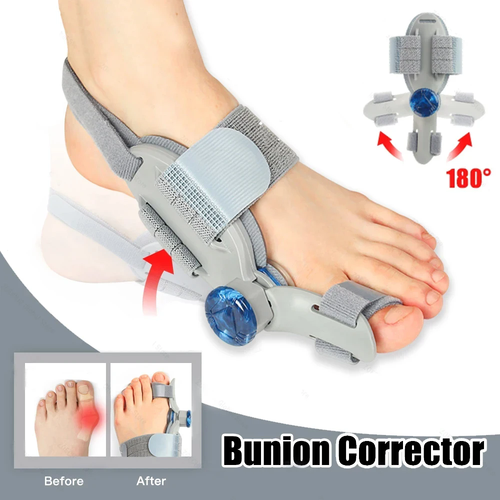 Bunion Fix Toe Valgus Corrector – Adjustable Orthosis Splint for Pain Relief & Alignment