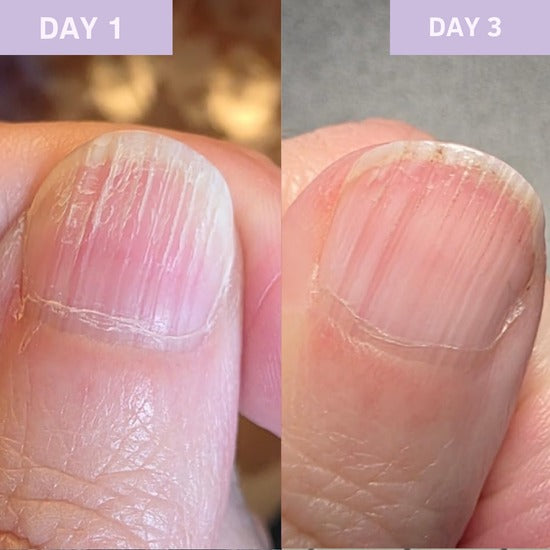 Nail Care Oil – Nourishing Cuticle & Nail Treatment for Natural Shine