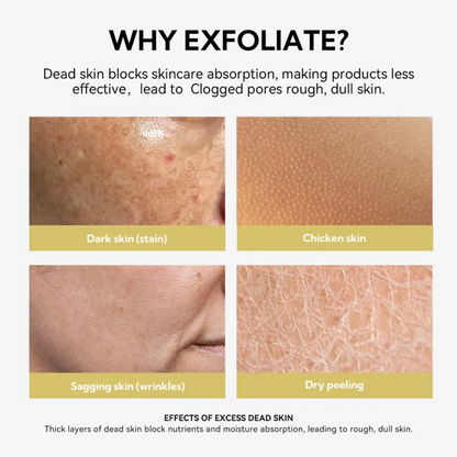 Exfoliating Peel Spray for Body – Aloe Vera Hydrating Skin Renewal