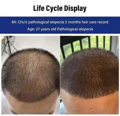 Anti-Hair Loss & Hair Growth Shampoo