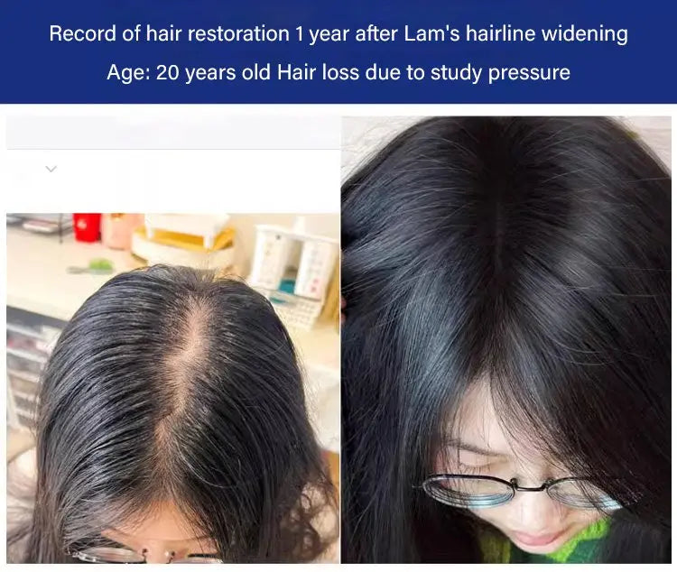 Anti-Hair Loss &amp; Hair Growth Shampoo