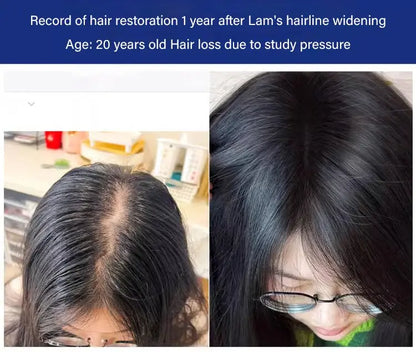 Anti-Hair Loss &amp; Hair Growth Shampoo