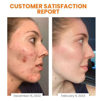 Vitamin C Brightening Soap