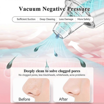 Blackhead Remover Pore Vacuum – USB Facial Pore Cleaning & Suction Device