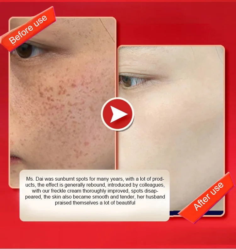 Brightening and Whitening Spot-Removing Face Mask