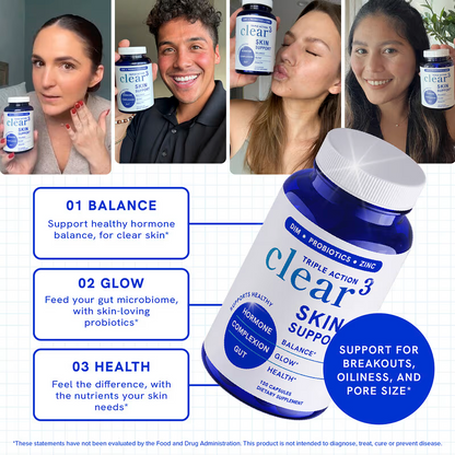 Skin Support Supplement with Zinc & Probiotics for Adults (60 Capsules)