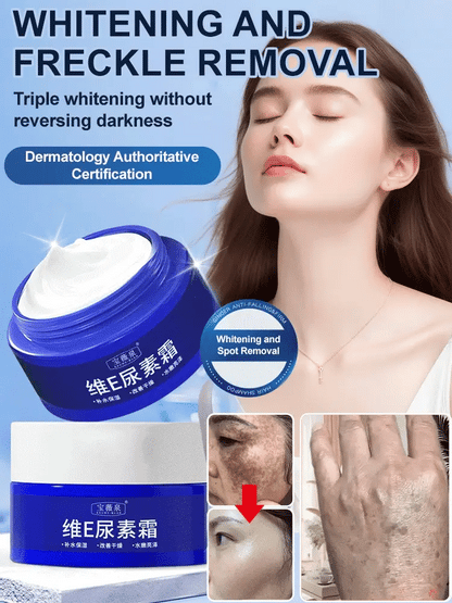 Spot Fading Urea Cream - JAPAN
