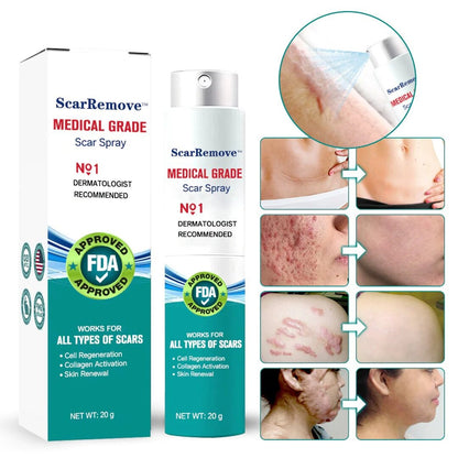 Advanced Scar Removal Spray