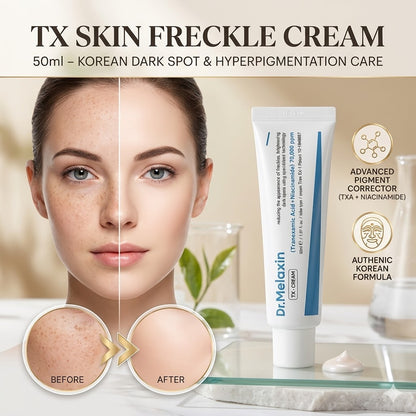 TX Skin Freckle Cream – Korean Dark Spot & Hyperpigmentation Care