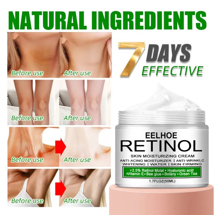 Body Whitening & Brightening Cream – Targeted Care for Underarm, Knees & Intimate Areas