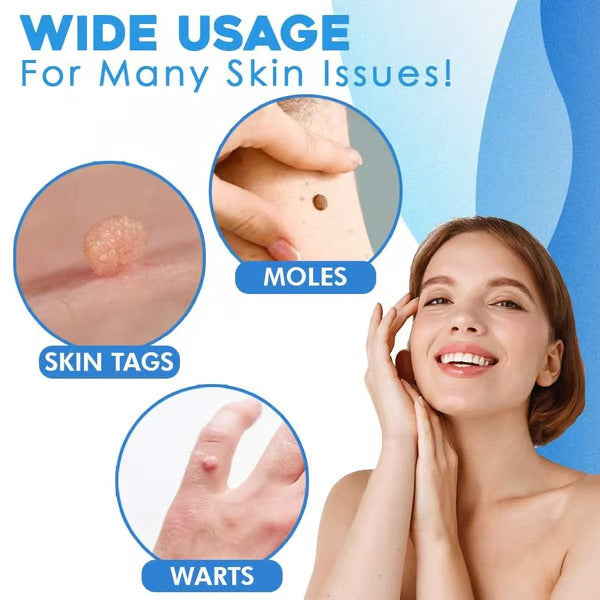 Auto Skin Tag Rapid Removal Kit