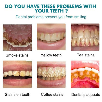 Teeth Whitening Paint — Instantly Brighter Smile
