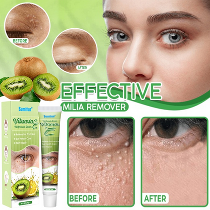 Eye Milia Removal Cream Sumifun