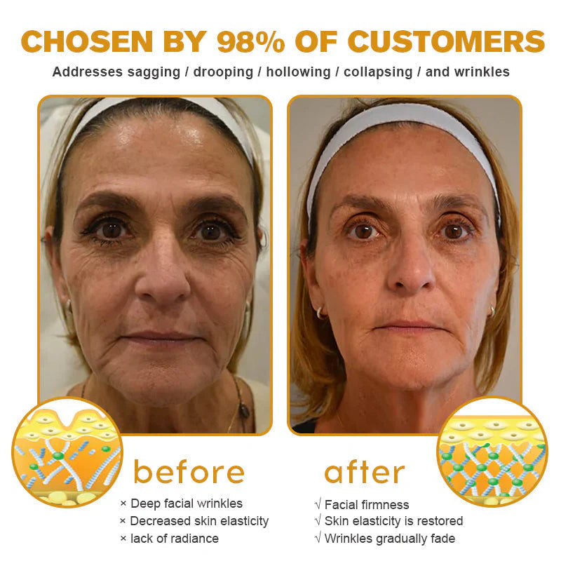 Bee Venom Wrinkle Cream – Smooth, Lift & Rejuvenate Naturally
