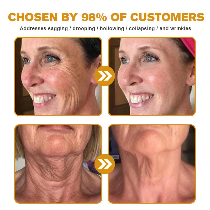 Bee Venom Wrinkle Cream – Smooth, Lift & Rejuvenate Naturally