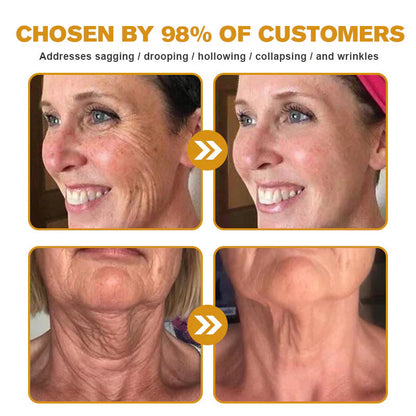 Bee Venom Wrinkle Cream – Smooth, Lift & Rejuvenate Naturally