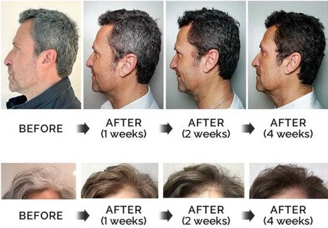 DARKA Anti-Grey Hair Serum