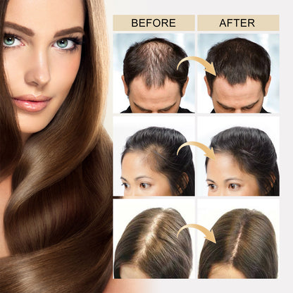 Ceoerty™ HGrow Rice Water Hair Essence:
